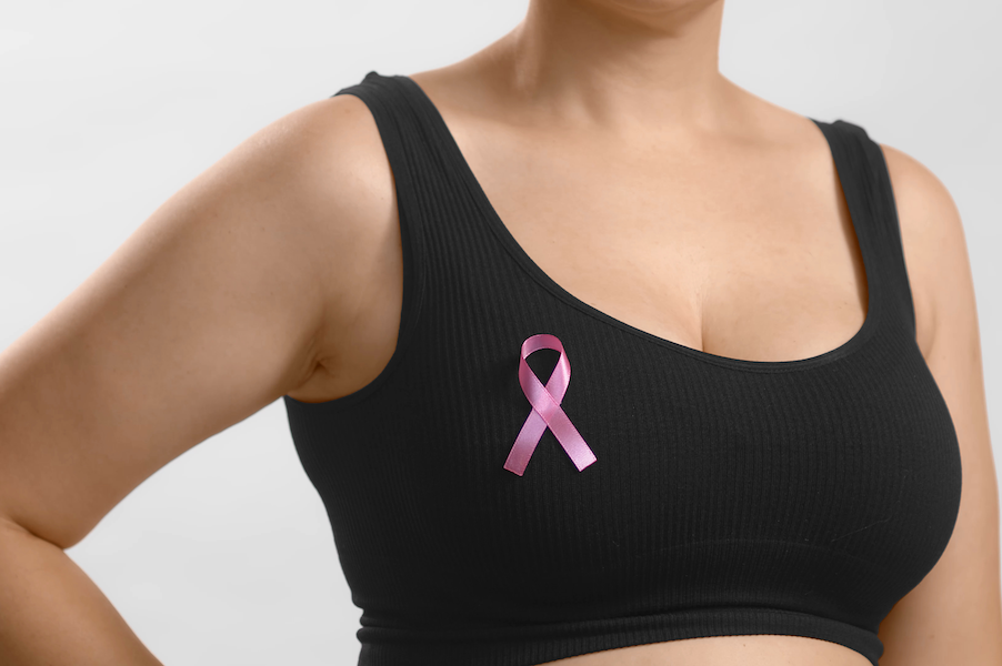 Understanding Breast Cancer Stages: A Complete 2025 Guide