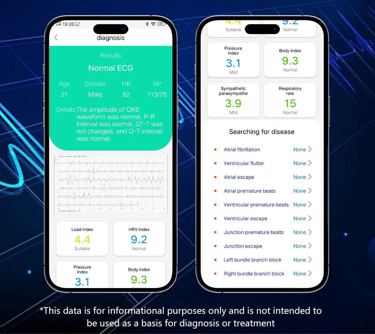 Why Choose a BP Doctor Smartwatch for Accurate Blood Pressure Readings?